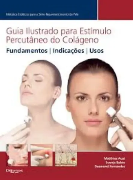 Imagem de Guia Ilustrado para Estímulo Percutâneo do Cologénio