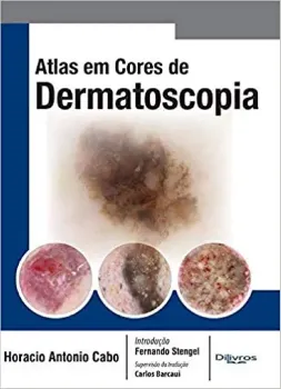 Imagem de Atlas em Cores de Dermatoscopia