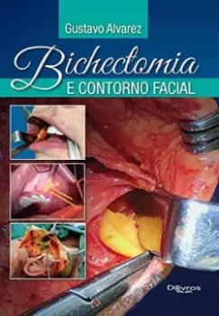Picture of Book Bichectomia e Contorno Facial