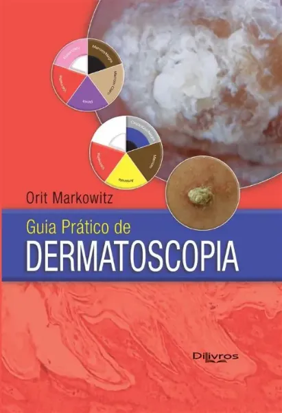 Imagem de Guia Prático de Dermatoscopia