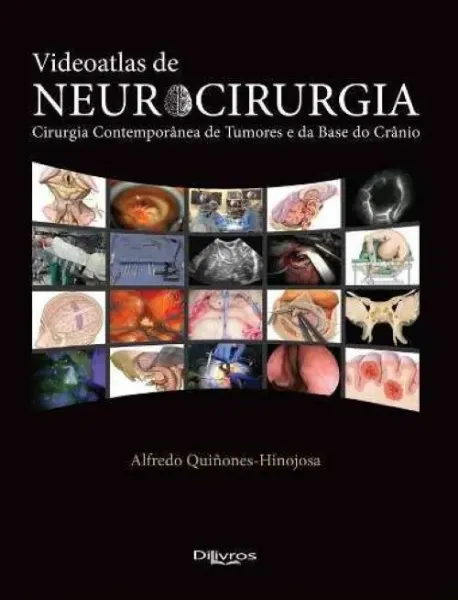 Imagem de Videoatlas de Neurocirurgia