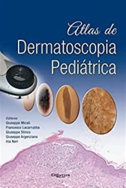 Imagem de Atlas de Dermatoscopia Pediátrica