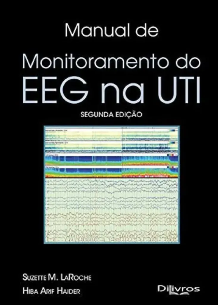Imagem de Manual de Monitoramento do EEG na UTI