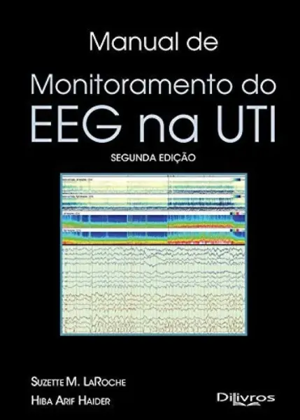 Imagem de Manual de Monitoramento do EEG na UTI