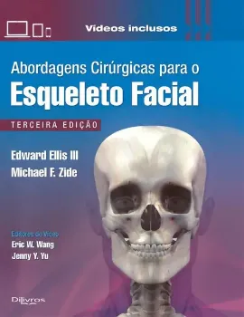 Imagem de Abordagens Cirúrgicas para o Esqueleto Facial