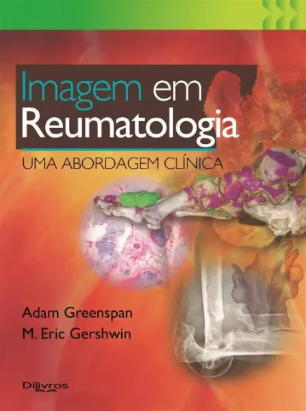 Imagem de Imagem em Reumatologia