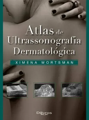 Picture of Book Atlas de Ultrasonografia Dermatológica