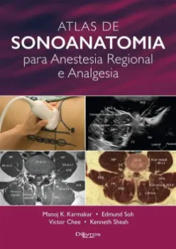 Picture of Book Atlas de Sonoanatomia para Anestesia Regional e Analgesia