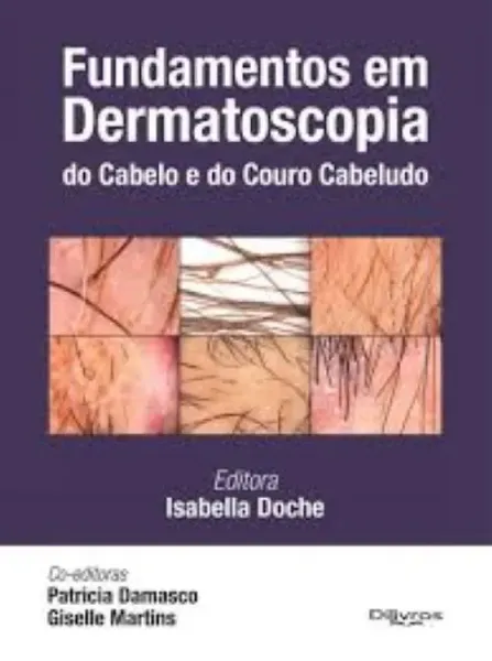 Imagem de Fundamentos em Dermatoscopia do Cabelo e do Couro Cabeludo