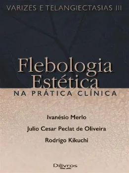 Imagem de Varizes e Telangiectasias III - Flebologia Estética na Prática Clínica