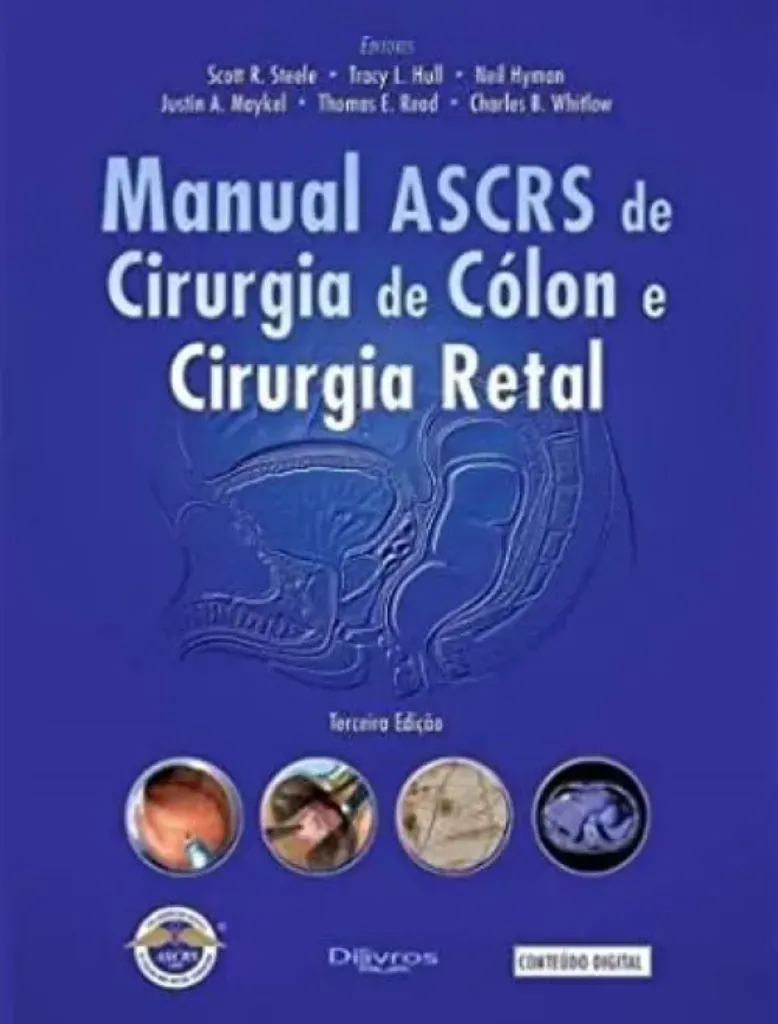 Imagem de Manual de Ascrs de Cirurgia de Colon e Cirurgia Retal