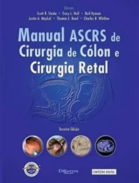 Imagem de Manual de Ascrs de Cirurgia de Colon e Cirurgia Retal