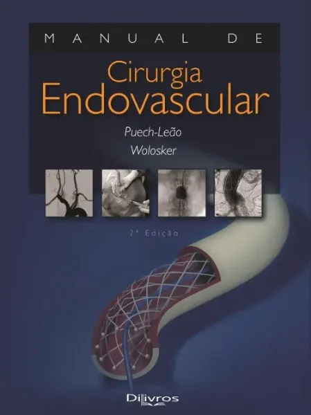 Imagem de Manual de Cirurgia Endovascular