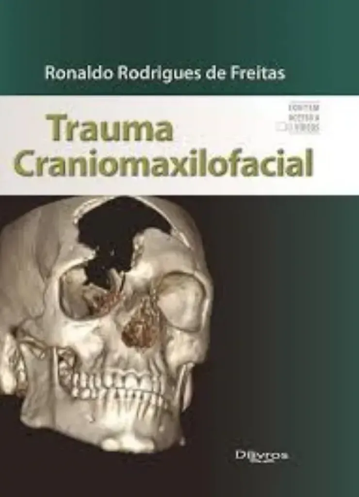 Imagem de Trauma Craniomaxilofacial