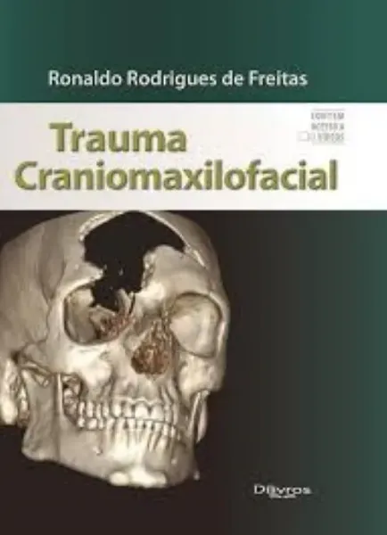 Imagem de Trauma Craniomaxilofacial