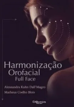 Imagem de Harmonização Orofacial Full Face