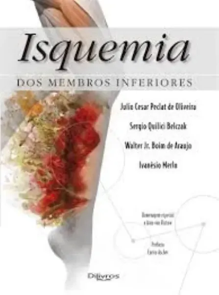 Imagem de Isquémia dos Membros Inferiores