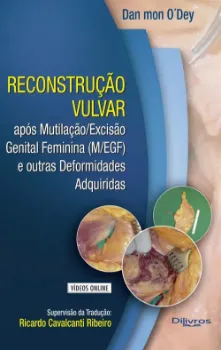 Imagem de Reconstrução Vulvar com Vídeo