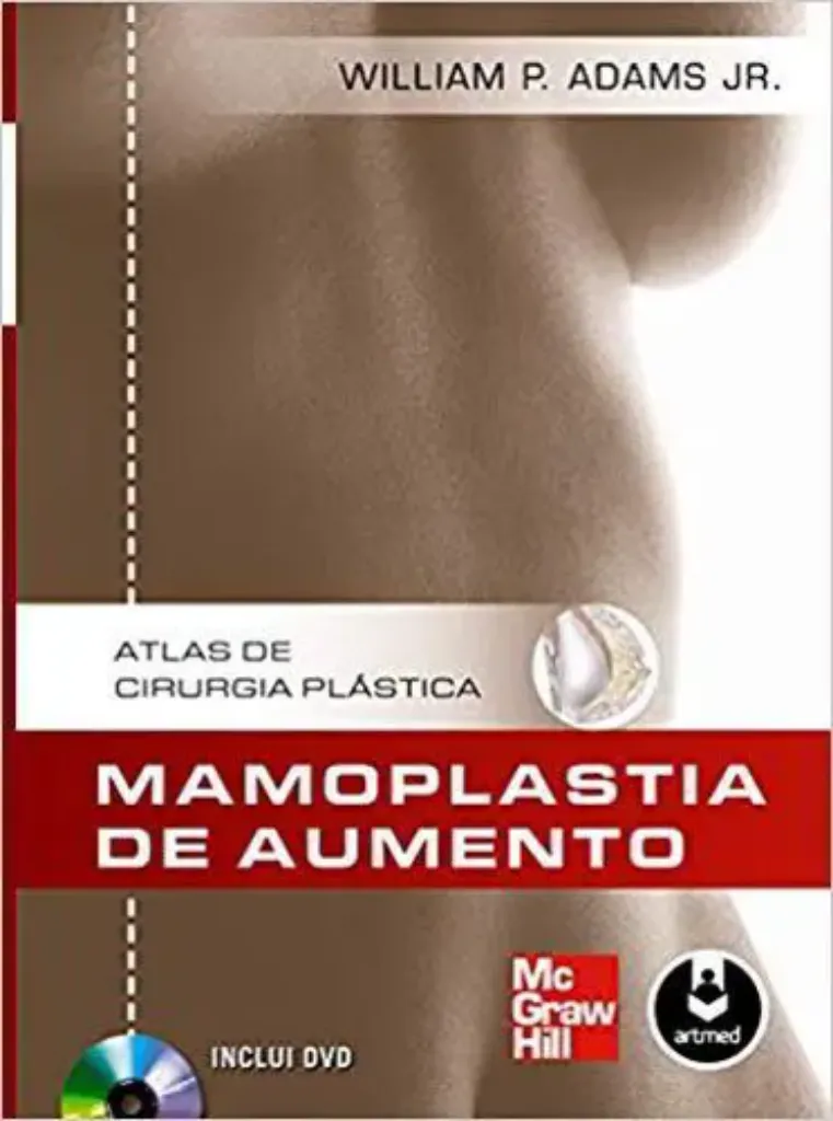 Imagem de Mamoplastia de Aumento