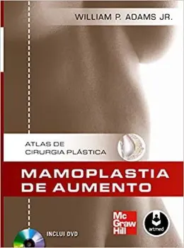 Picture of Book Mamoplastia de Aumento