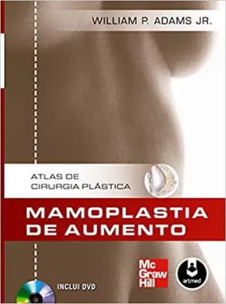 Imagem de Mamoplastia de Aumento