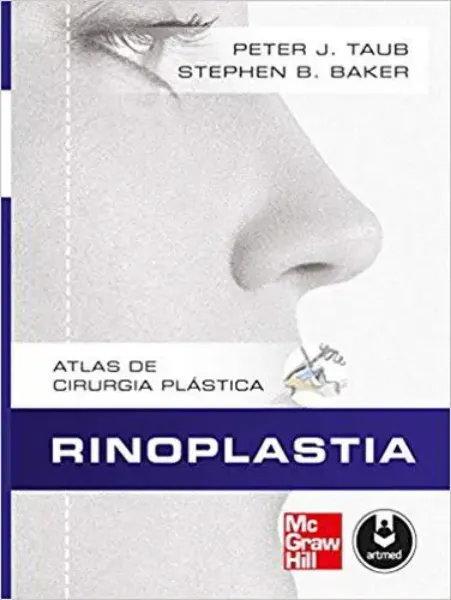 Imagem de Rinoplastia