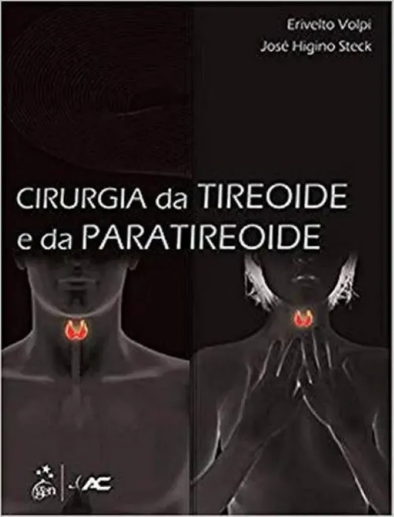 Imagem de Cirurgia Tireoide e da Paratireoide