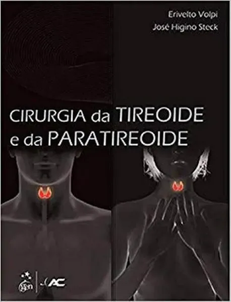 Imagem de Cirurgia Tireoide e da Paratireoide