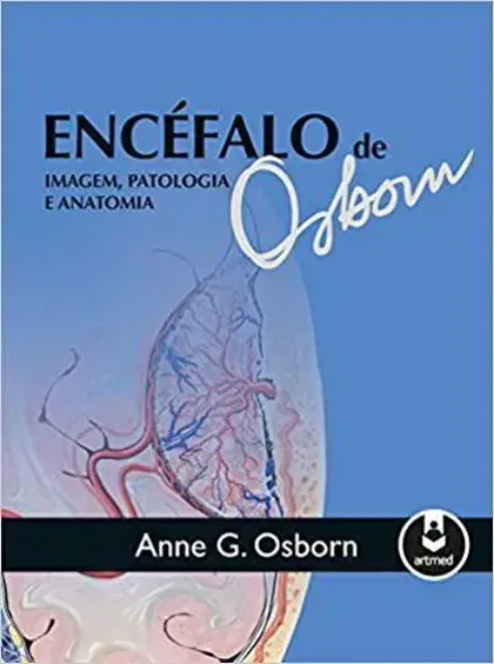 Imagem de Encéfalo de Osborn