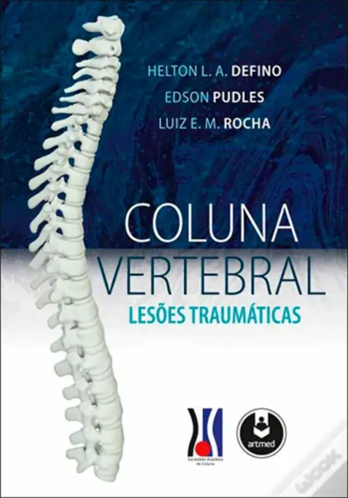 Imagem de Coluna Vertebral - Lesões Traumáticas