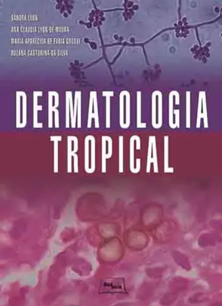 Imagem de Dermatologia Tropical