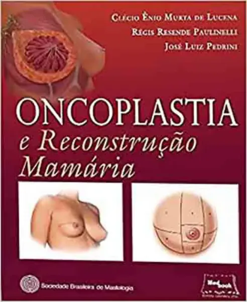 Picture of Book Oncoplastia e Reconstrução Mamária