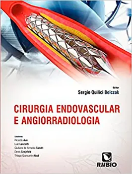 Imagem de Cirurgia Endovascular e Angiorradiologia