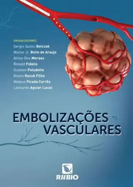 Imagem de Embolizações Vasculares
