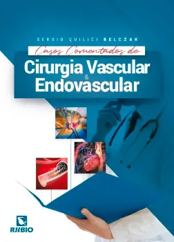 Imagem de Casos Comentados de Cirurgia Vascular e Endovascular