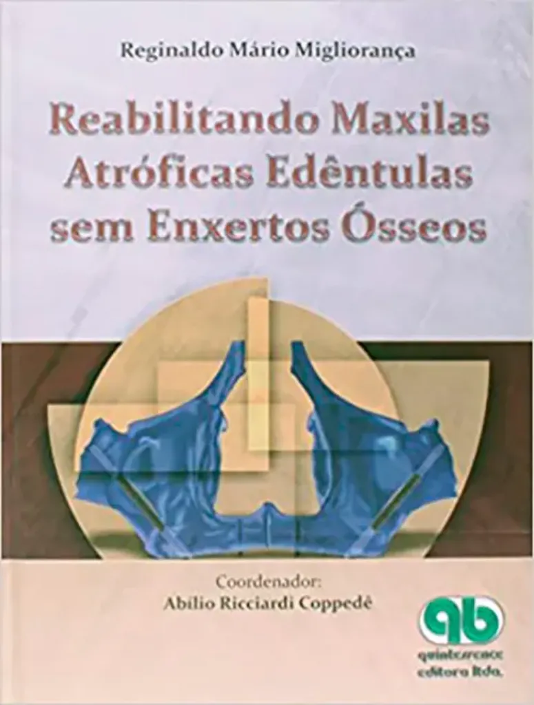 Imagem de Reabilitando Maxilas Atróficas Edentulas Sem Enxertos Ósseos