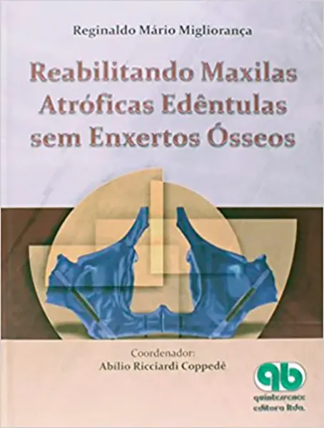 Imagem de Reabilitando Maxilas Atróficas Edentulas Sem Enxertos Ósseos