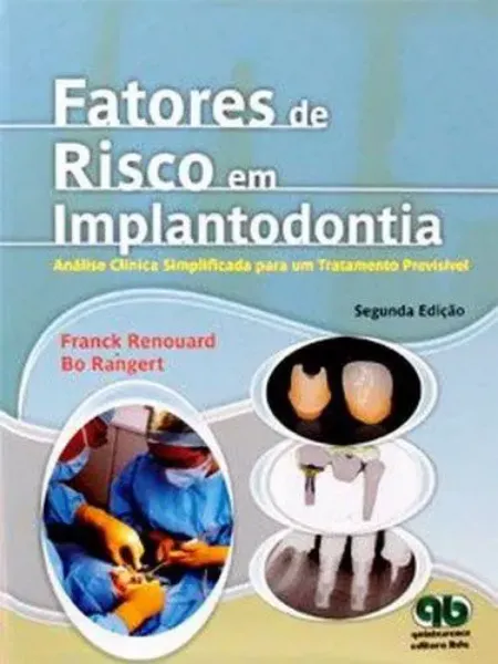 Imagem de Fatores de Risco em Implantodontia - Análise Clínica Simplificada para Um Tratamento Previsível