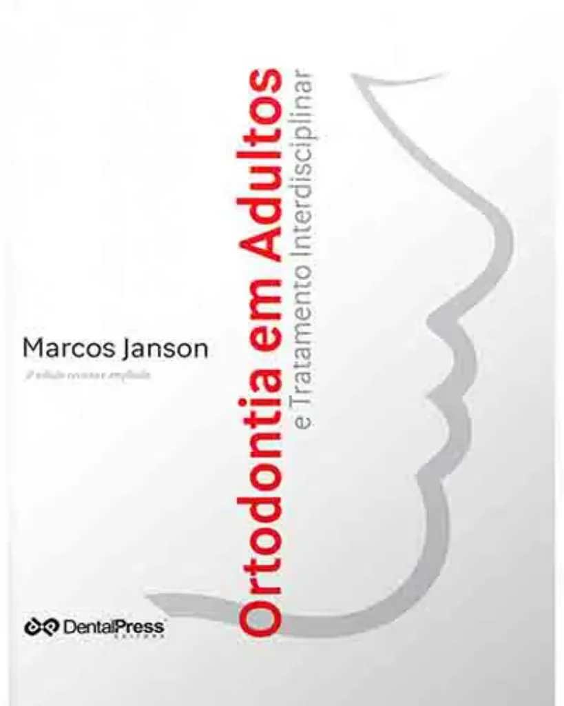 Imagem de Ortodontia em Adultos e Tratamento Interdisciplinar