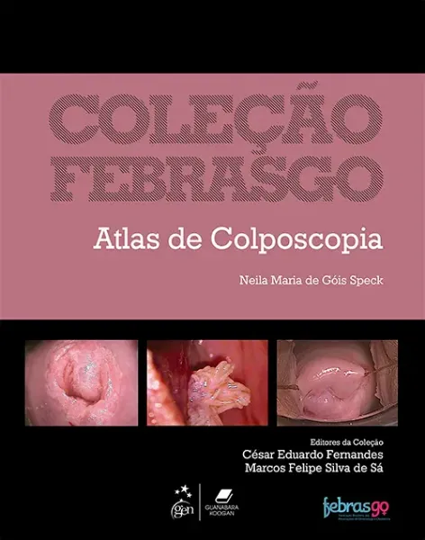 Imagem de Atlas de Colposcopia