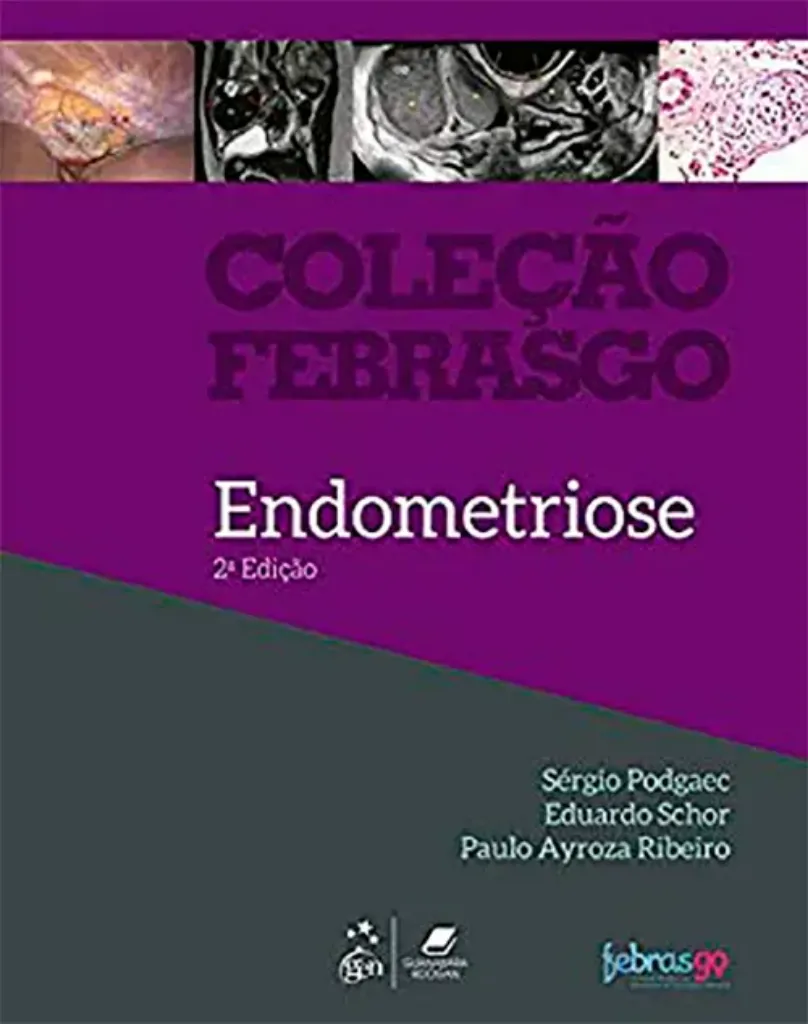 Imagem de Endometriose