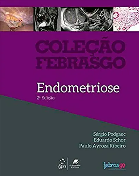 Imagem de Endometriose