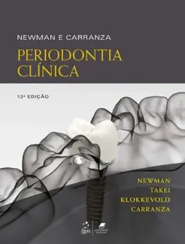 Picture of Book Newman e Carranza Periodontia Clínica