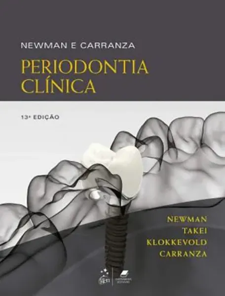Imagem de Newman e Carranza Periodontia Clínica