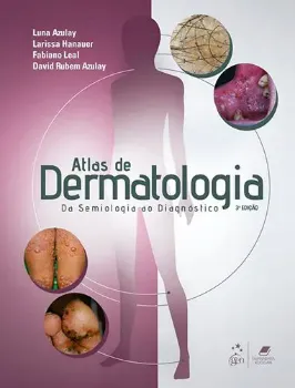 Imagem de Atlas Dermatologia Semiologia Diagnóstico