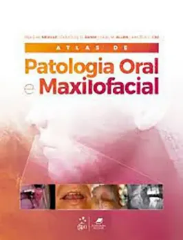 Picture of Book Atlas de Patologia Oral e Maxilofacial