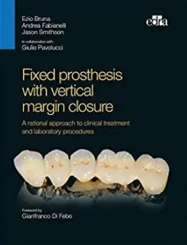 Picture of Book Fixed Prosthesis with Vertical Margin Closure