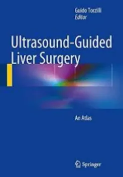 Picture of Book Ultrasound-Guided Liver Surgery