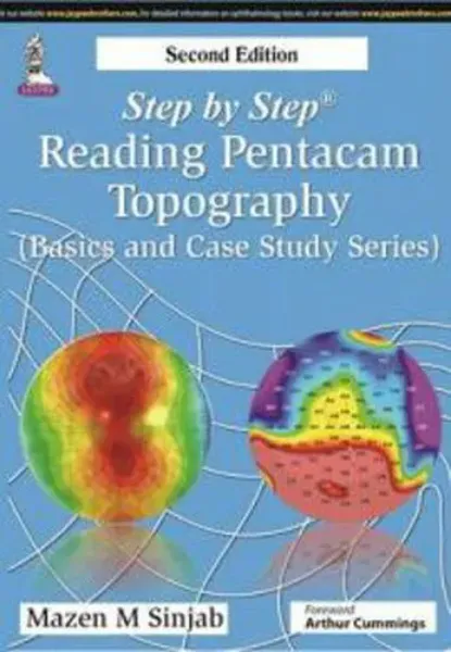 Imagem de Step by Step: Reading Pentacam Topography