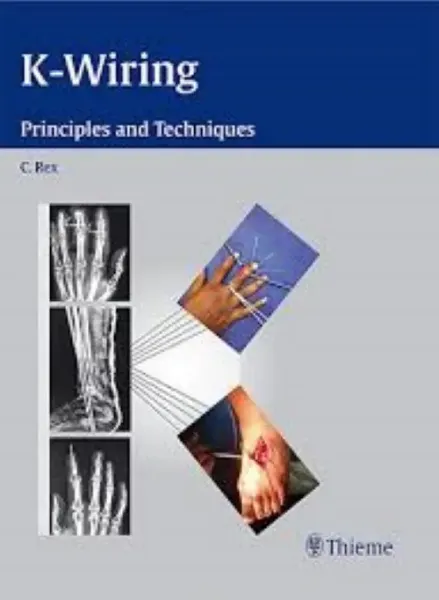 Imagem de K-Wiring: Principles and Techniques